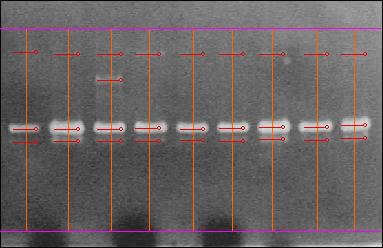 1 2 3 4 5 6 7 8 9 prommp-9 (94.0 kda) MMP-9 (68 kda) prommp-2 (65.0 kda) MMP-2 (52.0 kda) Γ. Υαλοειδές από μάρτυρες.