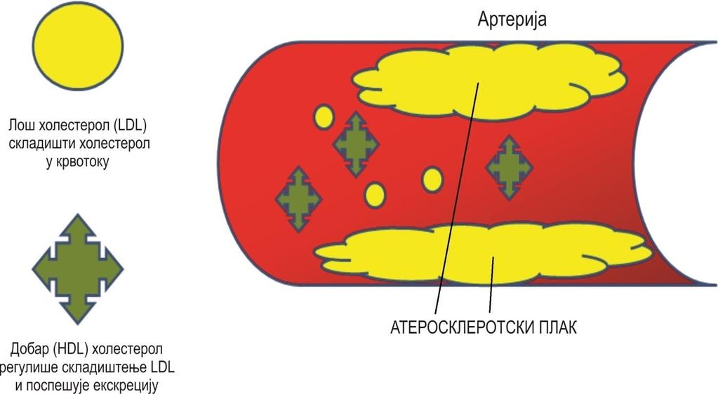 Увод олакшавају акумулацију холестеролских естара доводећи до стварања пенастих ћелија (34,35). Степен акумулације липида је критичан за дијагностику раних фаза атеросклерозе.