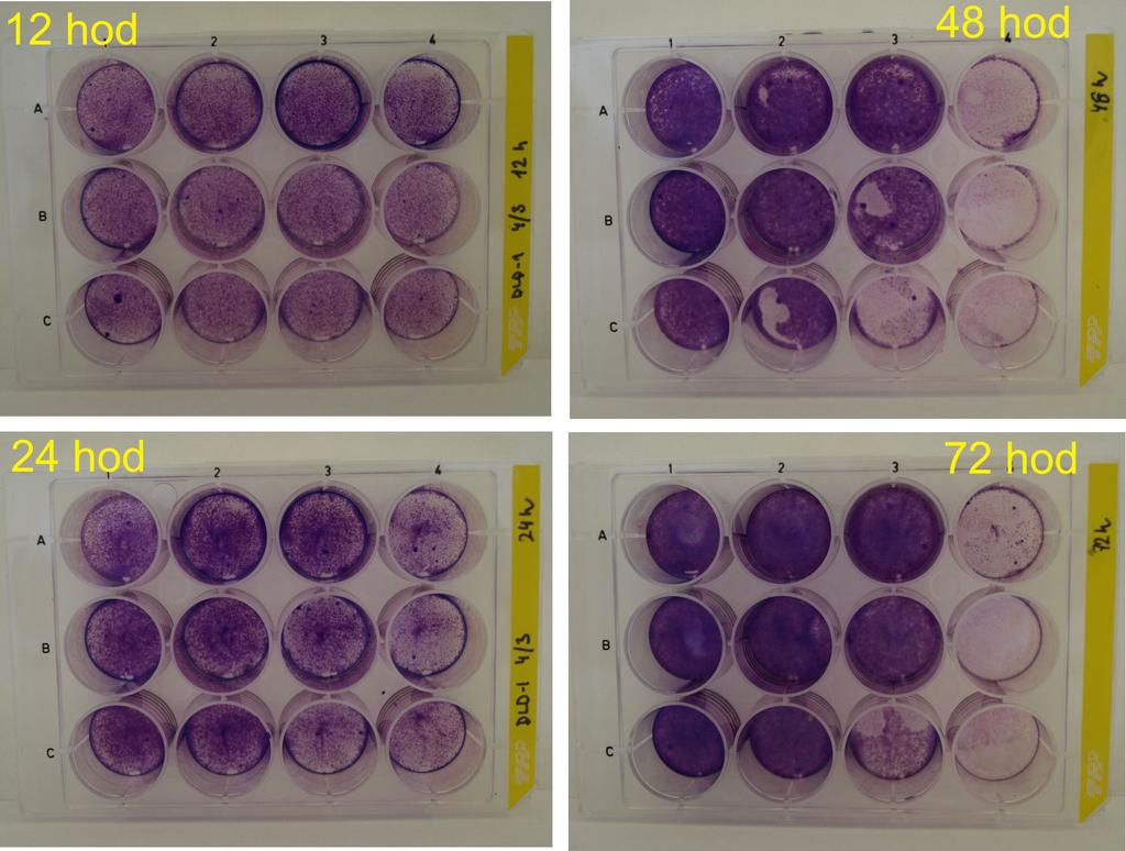 Výsledky Získané výsledky by sme podľa použitej metodiky rozdelili do dvoch oblastí. Na oblasť mikroskopickú (12-formátovú) a testovaciu (96-formátovú).