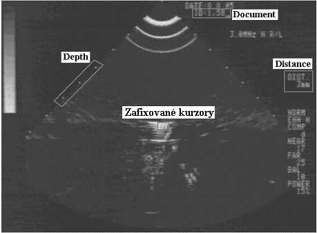 strane druhého kraja guličky nastavený a zafixovaný druhý merací kurzor. Vpravo sa potom pod nadpisom B-Distance objavila nameraná hodnota (+D =...mm).