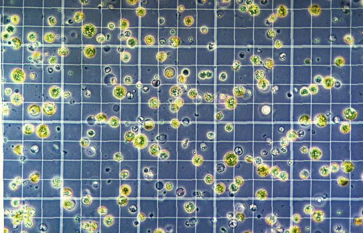 Phương pháp cơ bản tách tế bào trần Protoplast sẽ được xác định số lượng,