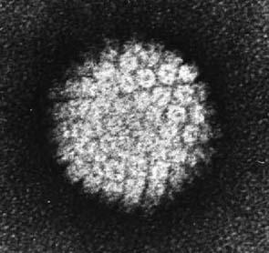 Human Papilloma Virus 6, 11 Ιός ανθρώπινων θηλωµάτων (HPV 6,11) Ιοί Μέγιστο Μέγεθος (nm).. 55 Κρούσµατα ανά έτος.. Ν/Α Επικινδυνότητα (σχετ.). 2 Οι τύποι (στελέχη) 6 και 11 του HPV είναι οι πιο συχνοί από τους καλοήθεις (χαµηλής επικινδυνότητας) τύπους του ιού.