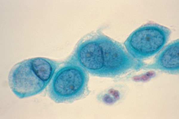Οι 12 κάρτες υπερατού ήταν οι εξής: Chlamydia trachomatis Χλαµύδια Βακτήρια Μέγιστο Μέγεθος (nm).. 1.000 Κρούσµατα ανά έτος.. 131.000.000 Επικινδυνότητα (σχετ.). 8 Η λοίµωξη από χλαµύδια είναι η πιο συχνή σεξουαλικά µεταδιδόµενη βακτηριογενής ασθένεια.