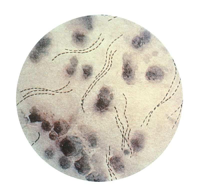 Haemophilus ducreyi Αιµόφιλος Βακτήρια Μέγιστο Μέγεθος (nm).