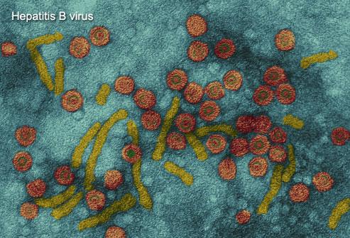 Hepatitis B Virus Ιός Ηπατίτιδας Β (HBV) Ιοί Μέγιστο Μέγεθος (nm).. 47 Κρούσµατα ανά έτος.. 4.500.000 Επικινδυνότητα (σχετ.). 17 Ο ΗBV προσβάλλει το ήπαρ και προκαλεί τη νόσο της ηπατίτιδας Β, µια ασθένεια µε υψηλή νοσηρότητα και θνησιµότητα παγκοσµίως.