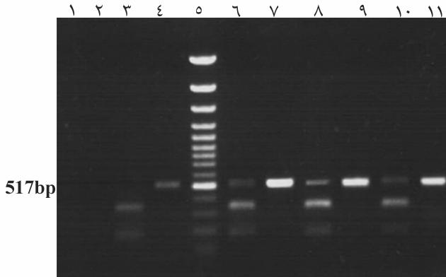 و 7 بررسي مولكولي فراواني كلاميديا تراكوماتيس در زنان شكل - نمايش محصولات PCR وRFLP نمونههاي ادرار. ستونهاي و نشاندهنده كنترل منفي (برش آنزيمي و محصول (PCR ميباشند.