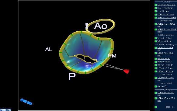 Parameters: -Annulus