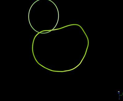 circumference -Mitral Valve