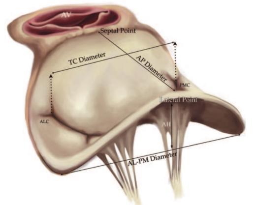 MITRAL