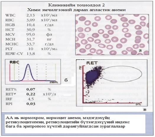 Лекц, тойм төрөлхийн юмуу олдмол хэлбэрээр илэрдэг бүлэг өвчин юм. Клиникийн онцлог зураглал нь цус багадах болон цус шүүрэх синдромууд хавсардаг.