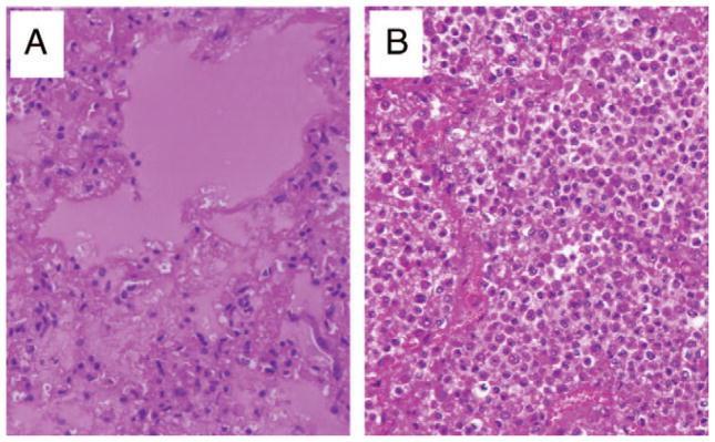 Μorens D et al, Crit Care Med