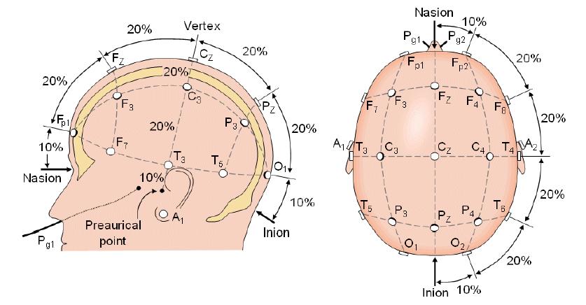 ηλεκτρόδιο ενεργής περιοχής και ένα ηλεκτρόδιο ανενεργής περιοχής, που ονομάζεται ηλεκτρόδιο αναφοράς και δεν εντοπίζει εγκεφαλική δραστηριότητα.