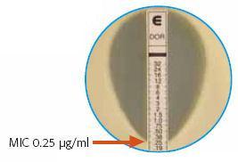 EUCST (European Committee on ntimicrobial Susceptibility Testing) θνικές επιτροπές (όπως BSC, SFM, DIN ) Αναλόγως