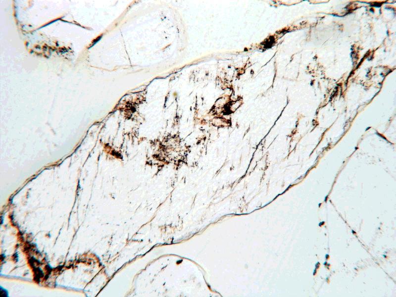 Microclin