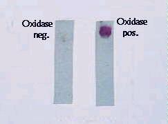 Oxidase Test 1.