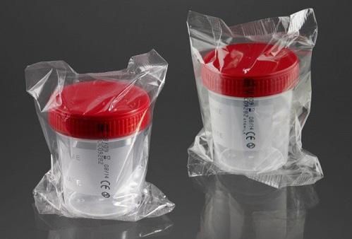 Korištenjem uređaja CoaguChek XS Plus dobivaju se pouzdani rezultati mjerenja INR-a izvan laboratorija;