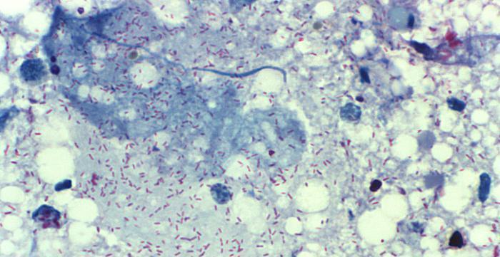 Rickettsia Gram (-), υποχρεωτικά ενδοκυττάρια βακτήρια Τάξη: α-πρωτεοβακτήρια,