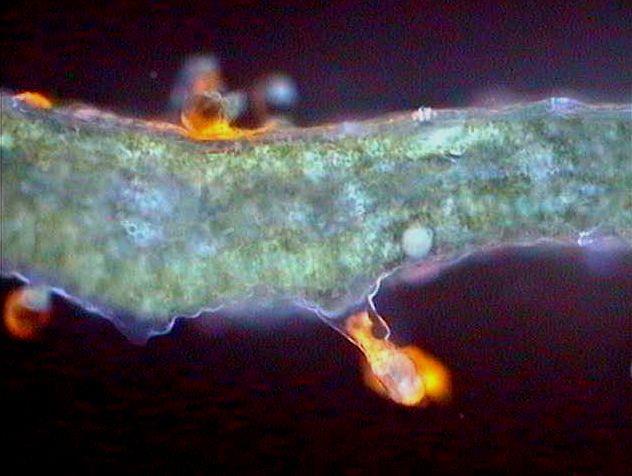 Η αλληλοπάθεια αφορά τις χημικές αλληλεπιδράσεις μεταξύ γειτονικών φυτών Εγκάρσια τομή φύλλου του φυτού Dittrichia viscosa, στο μικροσκόπιο φθορισμού.
