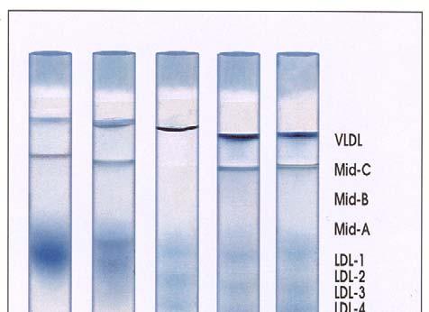 Lipoprint LDL
