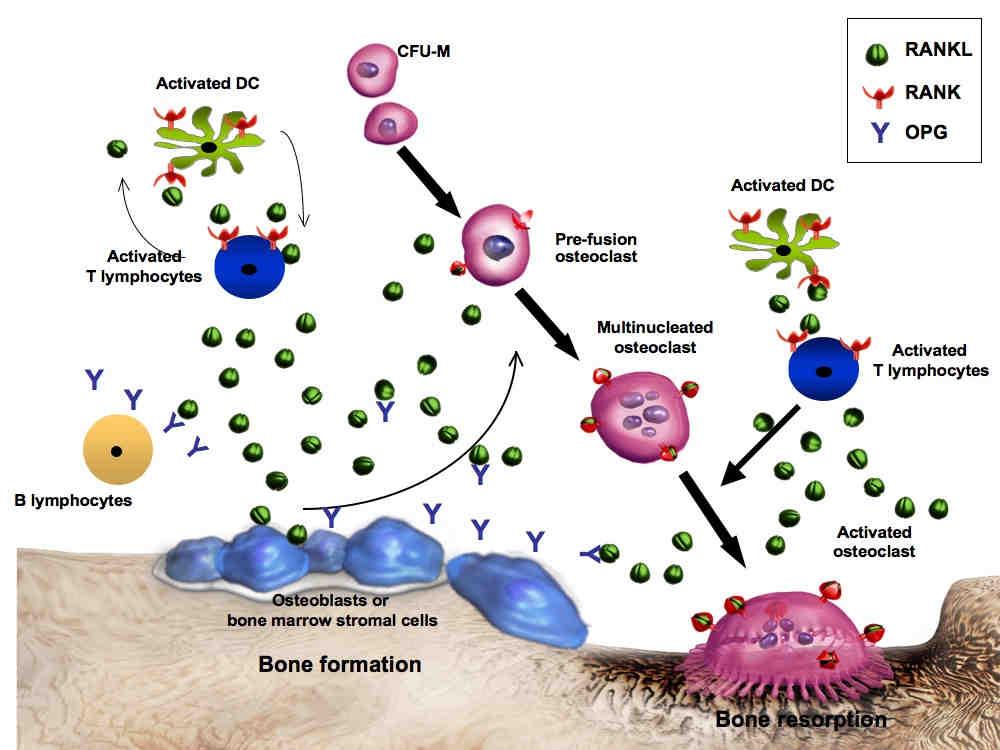 DENOSUMAB Humano, monoklonalno antitelo, IgG2 Tretman osteoporoze, gubitka koštane mase, koštanih metastaza, multiplog mijeloma Denosumab inhibira RANKL ligand (receptorski aktivator za