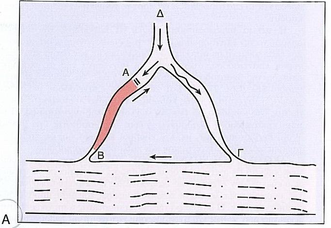 Εικόνα 3: ιάγραµµα επανεισόδου που δηµοσιεύτηκε από τους Schmitt και Erlanger το 1928. Μία ίνα του Purknje ( ) διαχωρίζεται σε δυο οδούς (Β και Γ), οι οποίες συνδέονται µε το κοιλιακό µυοκάρδιο.
