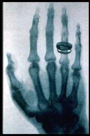 Slika 3.11. Ljudska ruka Fotografski zapis na filmu nastao prolaskom rendgenskih zraka kroz tijelo pokazivao je sliku unutarnjih organa.
