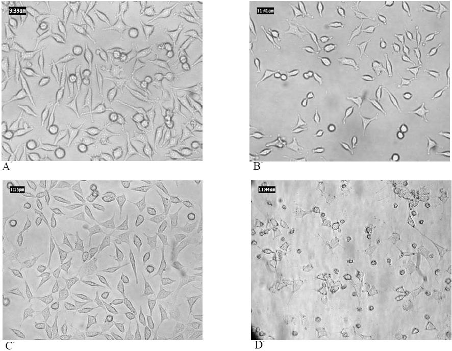 156/ مجله علوم پزشكي دانشگاه آزاد اسلامي اثر سايتوتوكسيسيتي زعفران بر سلولهاي كارسينوماي كبد شكل 1- تغييرات مرفولوژيكي سلولها. A: سلولهاي نرمال L 929 بدون تاثير عصاره پس از 48 ساعت.