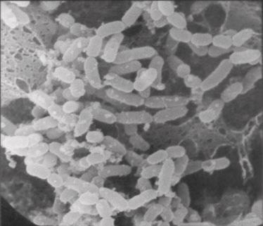 Προ- ΠΡΟΒΙΟΤΙΚΑ Παραδείγματα: Lactobacillus Bifidobacterium + Saccharomyces