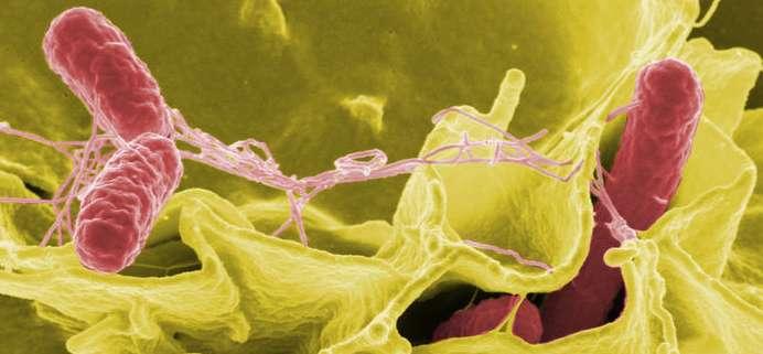 Color-enhanced scanning electron micrograph showing Salmonella typhimurium (red)