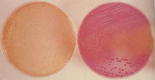 Growth of Enterobacteriaceae on MacConkey agar