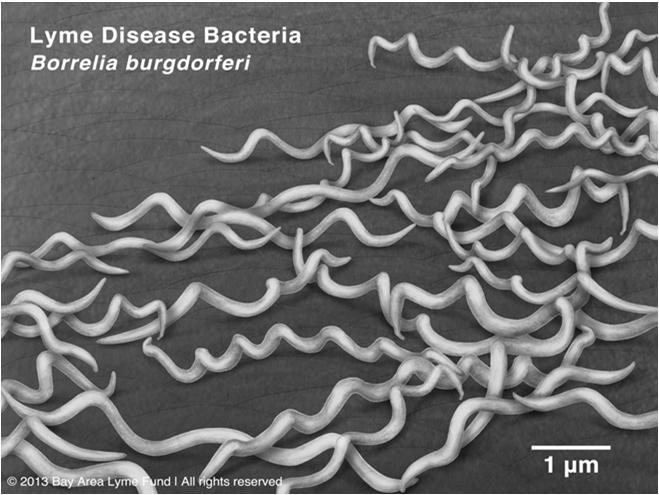 Η δομή των μικροβίων Oι μπορρέλιες είναι ελικοειδή μαστιγοφόρα βακτήρια με μήκος από 8 έως 30 μm και διάμετρο