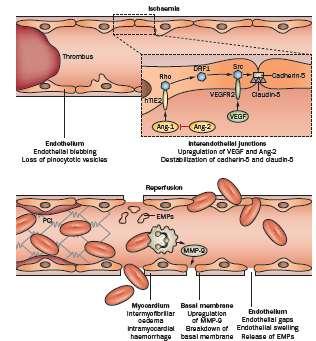 Απώλεια της ακεραιότητας του ενδοθηλίου λόγω της υποξίας Οίδημα ενδοθηλιακών κυττάρων Απελευθέρωση κυτοκινών οδηγεί σε φωσφορυλίωση της καντχερίνης προκαλώντας αυξημένη αγγειακή διαπερατότητα.