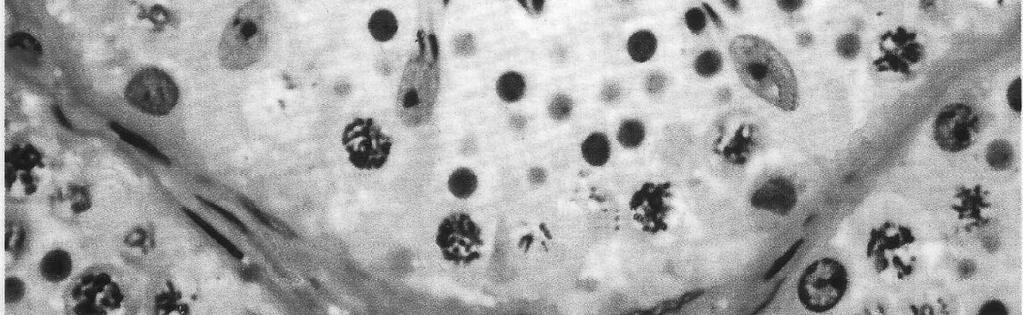 Slika 1 Deo testisa - semeni kanalić (SM, hematoksilin/eozin) Na snimku je prikazan deo zida semenog kanalića.