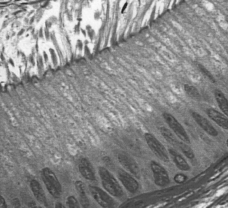 mioidne ćelije Lejdigova ćelija