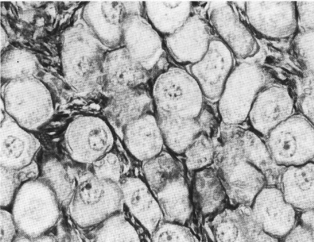 glavna ćelija stereocilije ćelija baze podepitelsko vezivo spermatozoid Slika 4 Primordijalni folikuli (SM, trojno bojenje) Na ovoj i sledeće dve mikrografije prikazani su različiti stupnjevi razvića