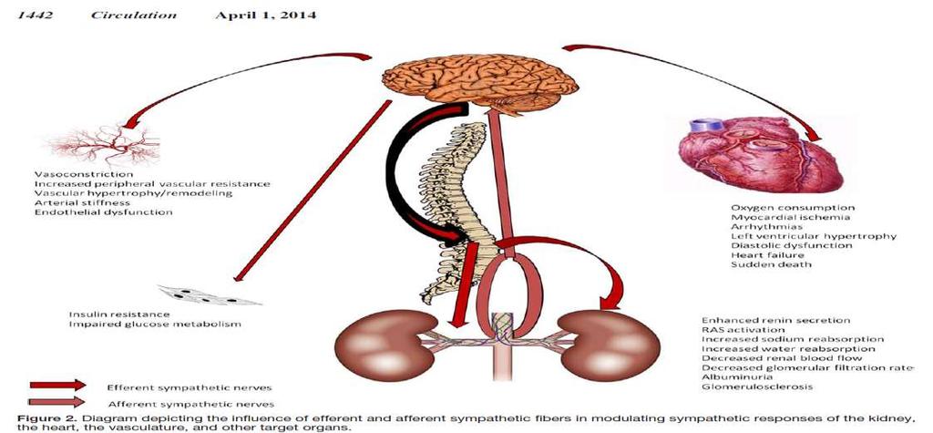 RDN: Strong pathophysiological background