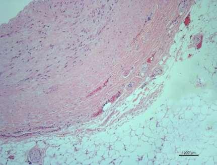 to the Renal Nerves that Help Control Blood
