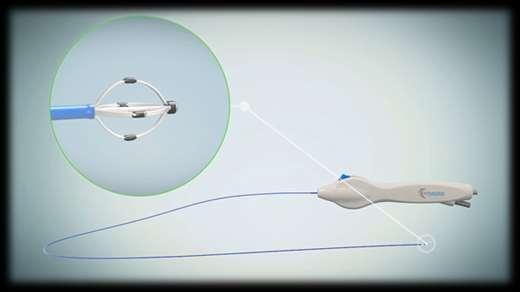 Catheter Multi-electrode