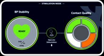 access approach Console