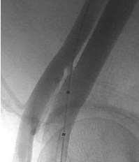 2009-Renal