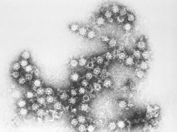 Εντεροϊοί - αιτιολογία Picorna ιοί (ssrna) περιλαμβάνουν 1. τον ιό της πολυομυελίτιδας, 2. τους ιούς Coxsackie A και B, 3. τους ιούς Echo και 4.