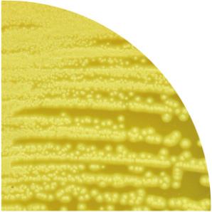 aureus ATCC 25923 + +, žute + Proteus mirabilis ATCC 14153 +, crvene Escherichia coli ATCC 25922 Pseudomonas aeruginosa ATCC 27853 inhibiran inhibiran