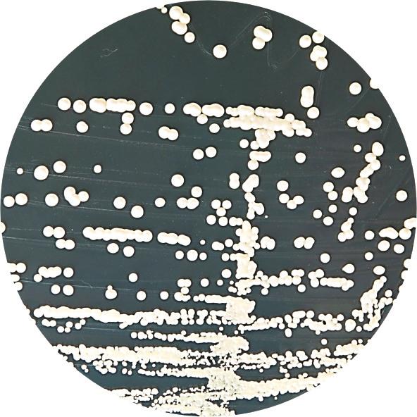 Mikrobiološka kontrola Gotovu podlogu inokulisa test kulturama i inkubira na 30 o C 35 o C u toku 18-48 časova, a za Aspergillus niger 3 do 5 dana na sobnoj temperaturi.