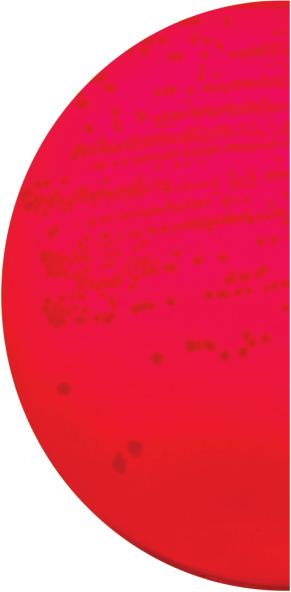ciklama Escherichia coli ATCC 25922 inhibiran žuto-zelene; žuto-zelenkasta Staphylococcus aureus ATCC 25923 Enterococcus faecalis ATCC 29212 SUVE PODLOGE Čuvanje Suva