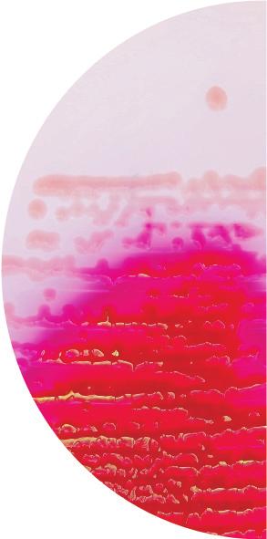 Očekivani rezulta : Organizam Rast Kolonije Escherichia coli ATCC 25922 + ružičasto-crvene, metalni sjaj Klebsiella