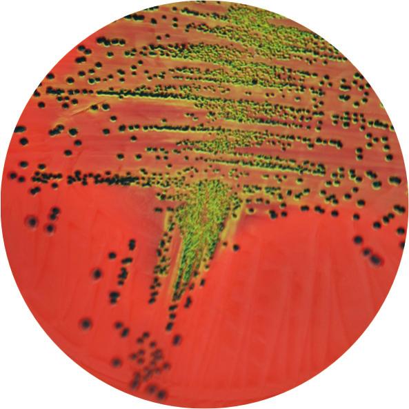 ATCC 13883 + braon-ljubičaste, mukoidne Salmonella enteri dis ATCC 13076 + bezbojne Proteus mirabilis ATCC 14153 + bezbojne