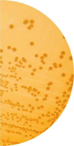 Očekivani rezulta : Organzam Rast Hidroliza eskulina Enterococcus faecalis ATCC 29212 + +