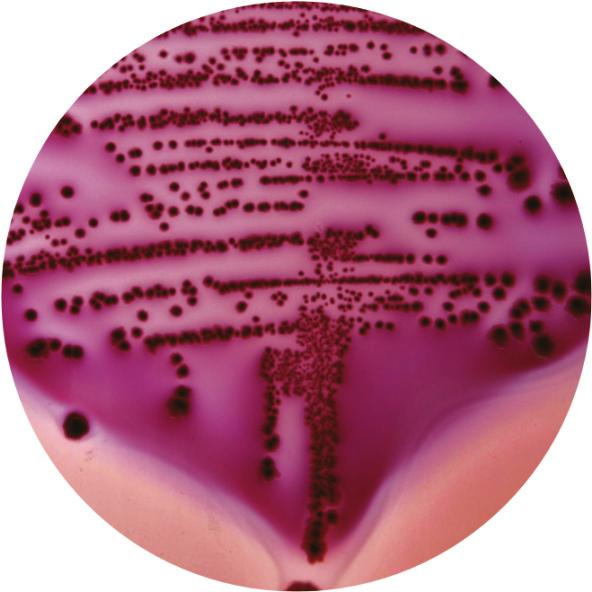 Bakterije koje ne fermentuju laktozu rastu kao bezbojne ili prozračne kolonije. Gram-pozi vne bakterije su uglavnom inhibirane, ali mogu da rastu kao bezbojne, sitne i suve kolonije.