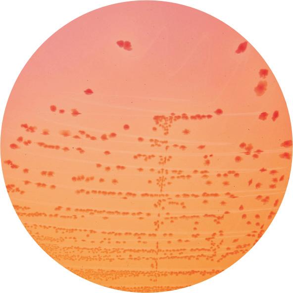 Očekivani rezulta : Organizam Rast Kolonije Žučni precipitat Escherichia coli ATCC 25922 + crveno-roze + Shigella flexneri ATCC 12022 + bezbojne Salmonella enteri dis ATCC