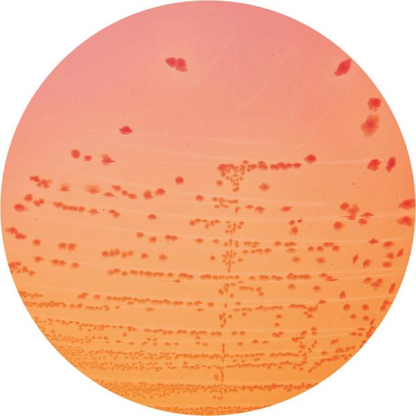 Očekivani rezulta : Organizam Rast Kolonije Žučni precipitat Escherichia coli ATCC 25922 + crveno-roze + Shigella flexneri ATCC 12022 + bezbojne Salmonella enteri dis ATCC